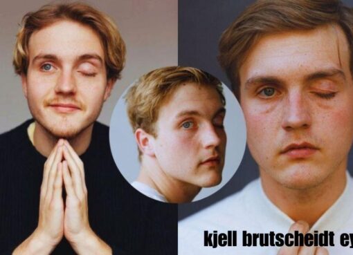 kjell brutscheidt eye