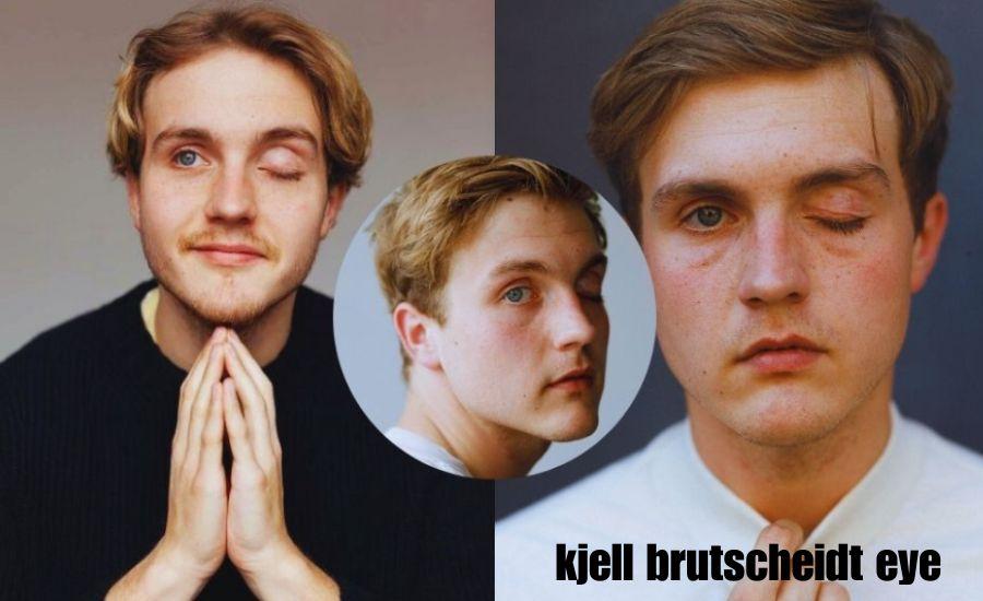 kjell brutscheidt eye